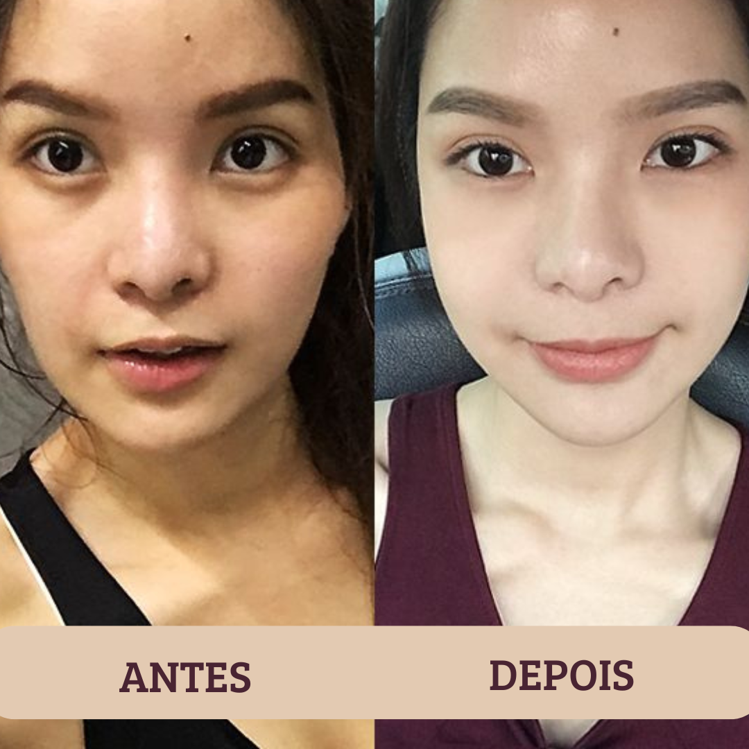 Antes y después - Julia